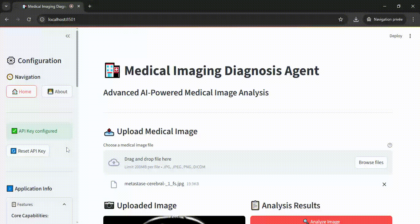 Medical Imaging Diagnosis Agent Demo